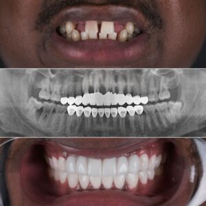 Traitements dentaires – Des solutions sûres et durables